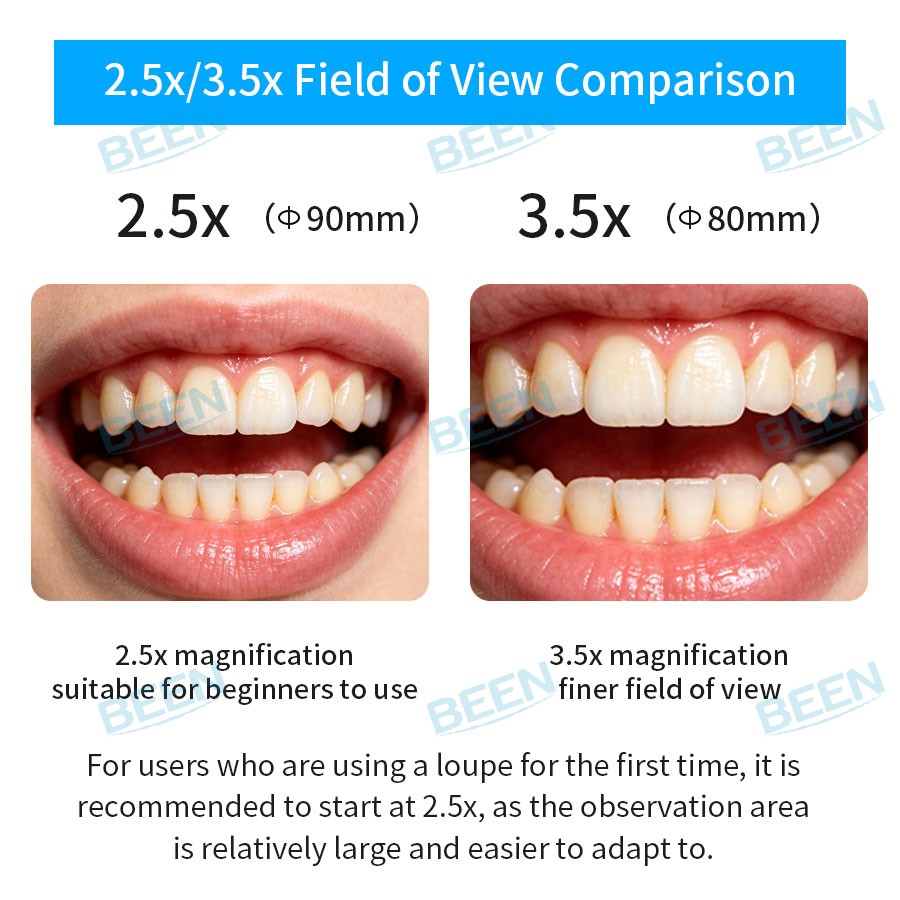 2.5x420mm 치과용 확대경 치과 실험실 의료용 확 - Medical Lab Usa 리뷰 및 가격